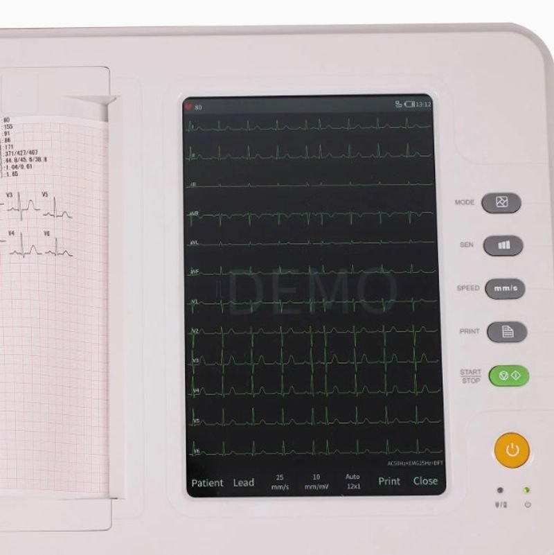 Contec new electrocardiograph ecg machine ecg1212g 09 04 2025 74c8048f - SkyMedIdent