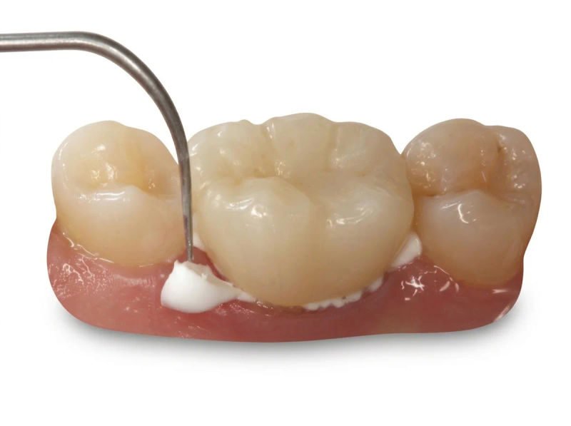 Pyrax type i luting gic 06 04 2026 9467b1ed - SkyMedIdent