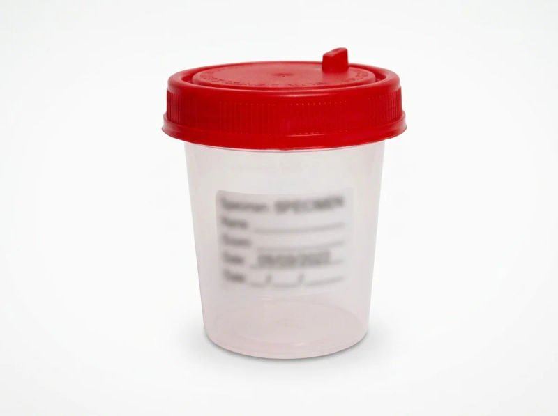 Romsons speci can specimen container 70ml pack of 50 sh 1074 12 06 2026 4213b26b - SkyMedIdent