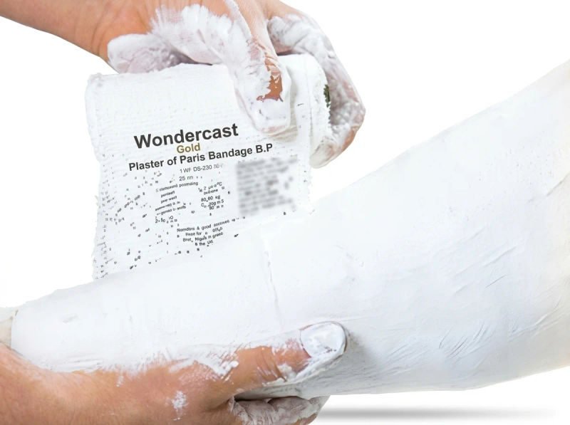Techeal wondercast gold plaster of paris bandage bp 75cm x 27mtr pack of 12 15 06 2026 2c3b66a9 - SkyMedIdent