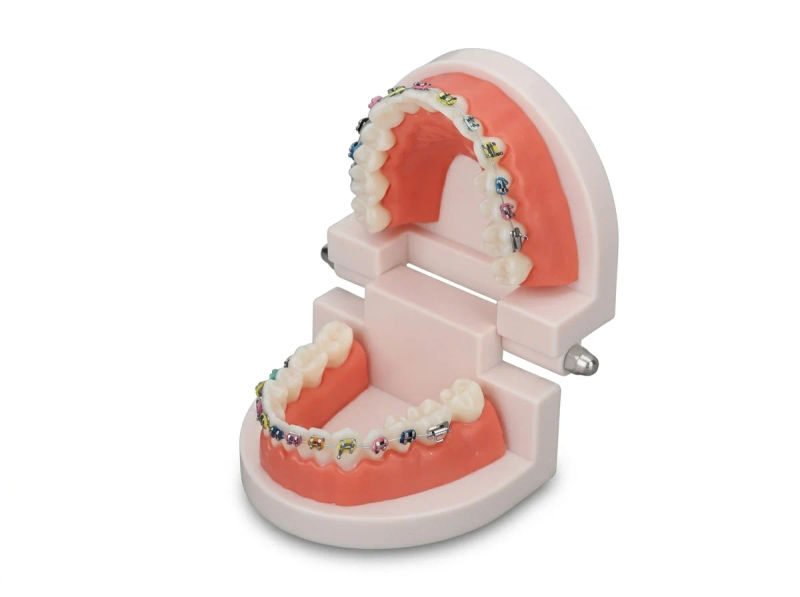 Unique dents ortho patient education model 05 05 2026 1ff1eb09 1 - SkyMedIdent