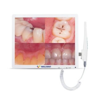 Waldent Smart Cam with PMS Intra Oral Camera