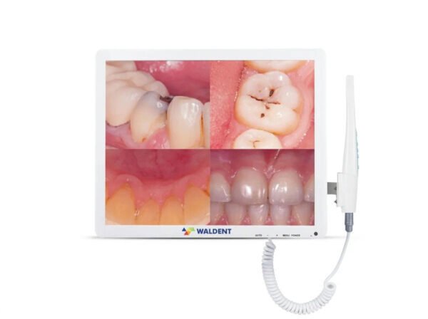 Waldent smart cam with pms intra oral camera 13 04 2026 3d355984 1 - SkyMedIdent