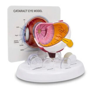 ASF Cataract Model Eye