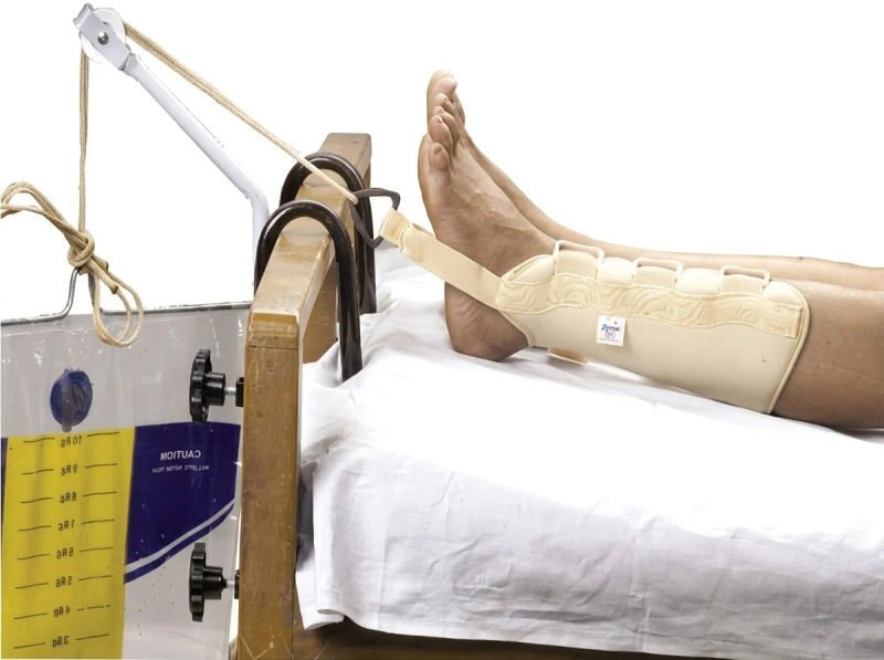 Dyna ankle traction beige small 1540 23 06 2026 2681f8eb - SkyMedIdent