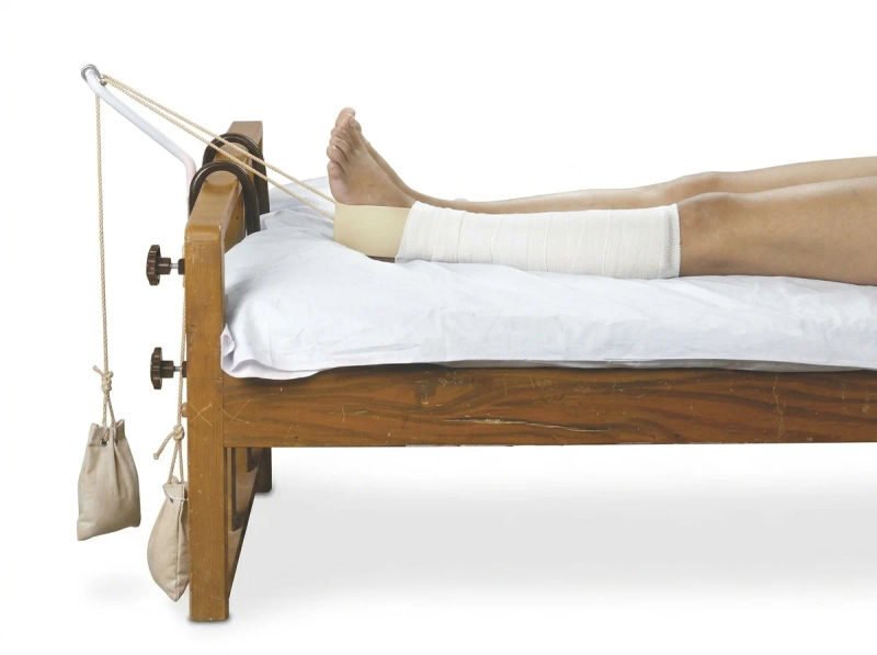 Dyna leg traction beige universal 1520 04 06 2026 86613894 - SkyMedIdent