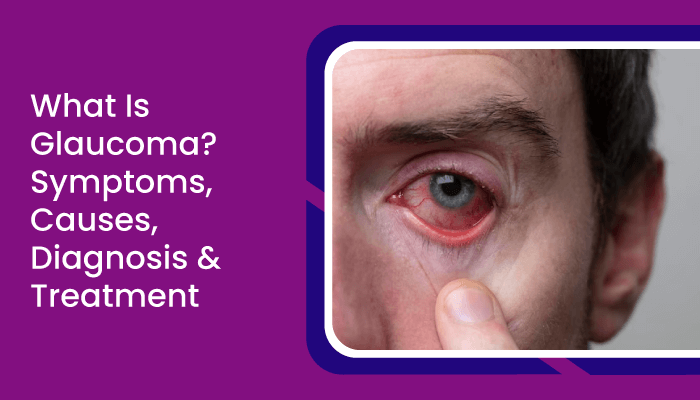 What Is Glaucoma Symptoms Causes Diagnosis Treatment