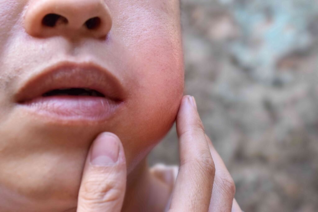 Understanding Mumps: Causes, Symptoms & Treatment | SkyMedIdent health GettyImages 1452880674 2927916171c6436694b0156f258b23f2
