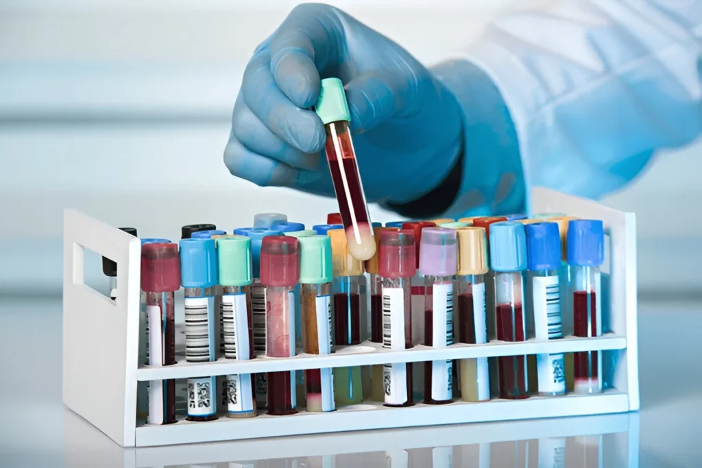 Diagnostics: Diagnostic Devices, Laboratory Equipment & Testing Solutions | SkyMedIdent steptodown.com148887 1024x683 1